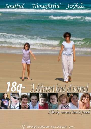 18q: A Different Kind of Normal
